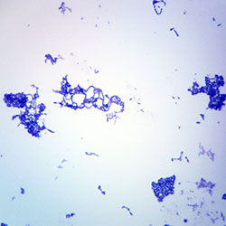 Microscope slide Streptococci