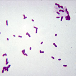 Mikroskopiskt preparat E. coli