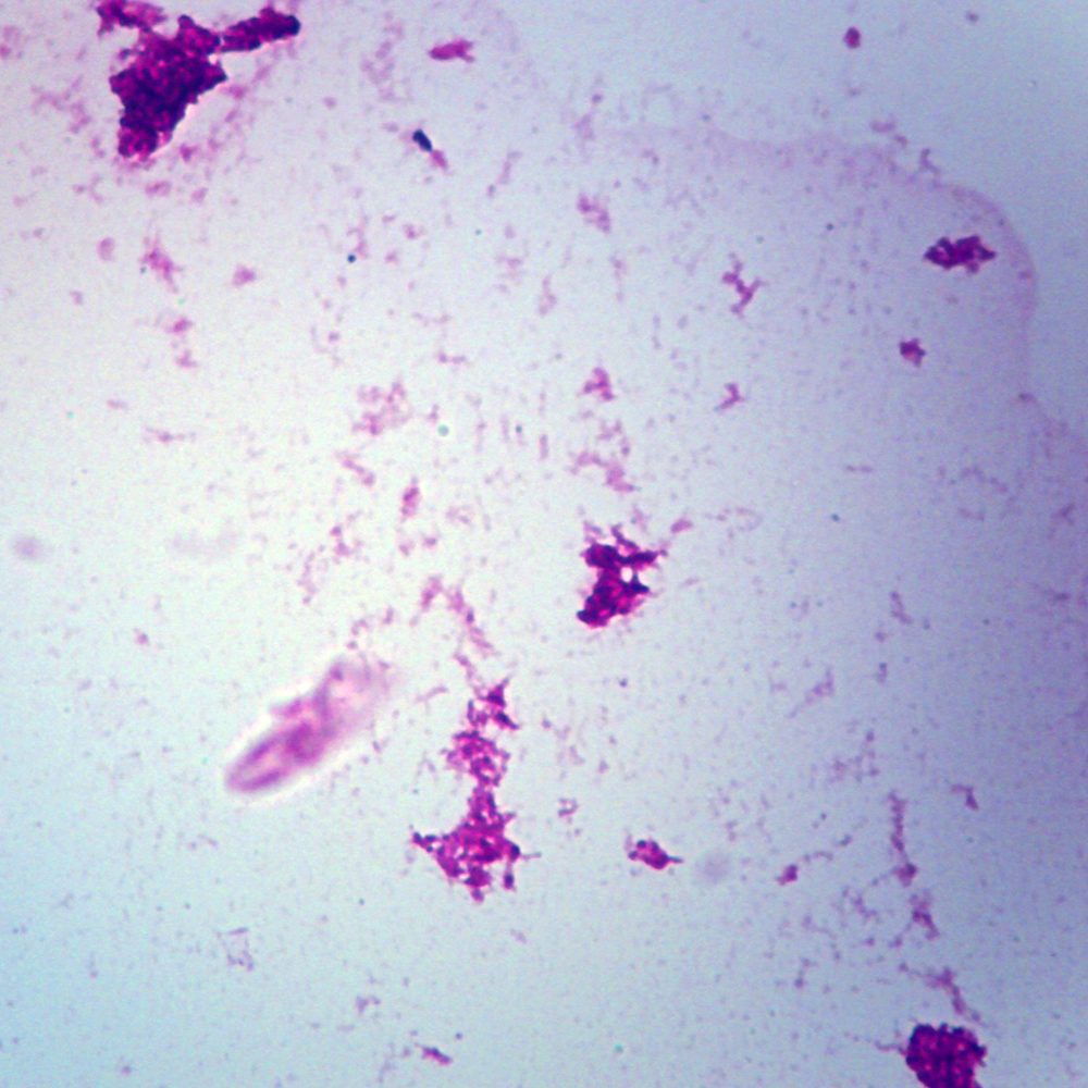 Mikroskopiskt preparat M. tuberculosis