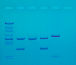 DNA-sormenjljet PCR I