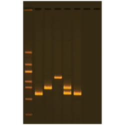 Test av vattenkvalitet med multiplex PCR